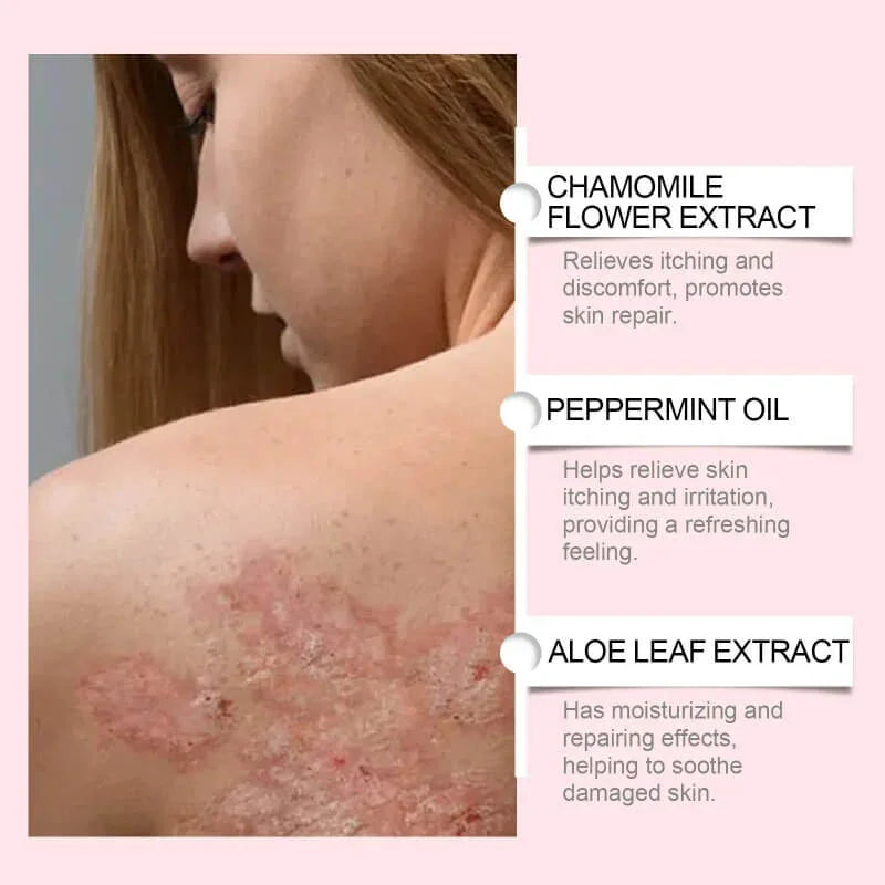 Woman with irritated, red, flaky skin on back, showing benefits of chamomile, peppermint oil, and aloe leaf extract for skin relief and repair.