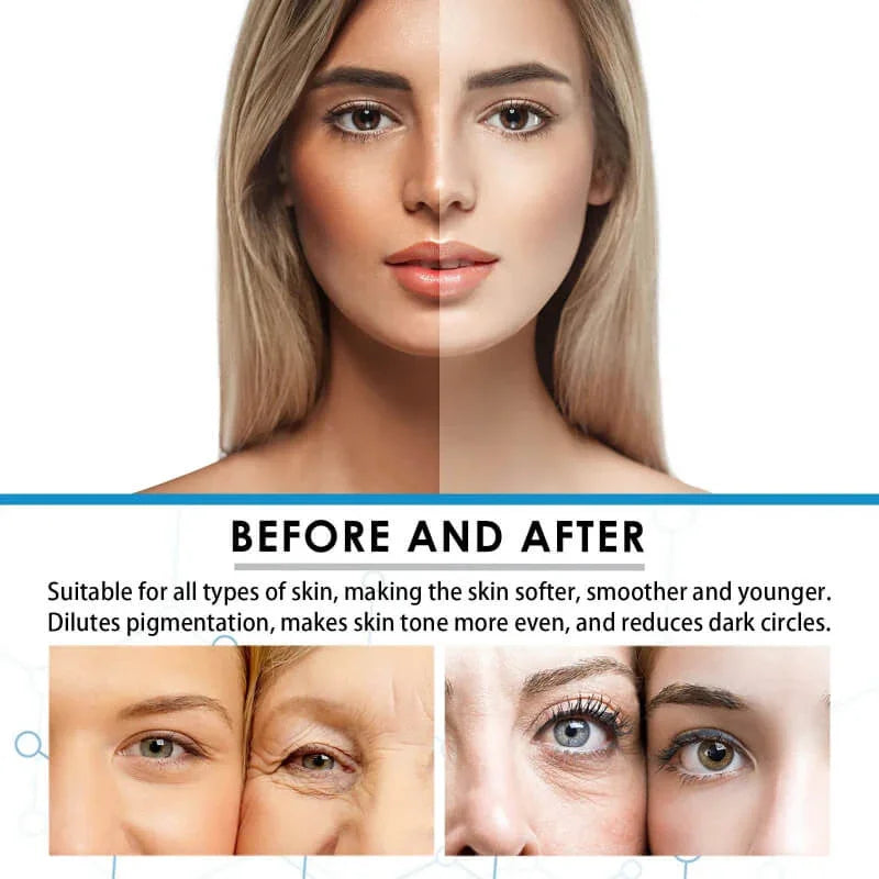Before and after facial skincare results showing improved skin tone, reduced pigmentation, smoother texture.