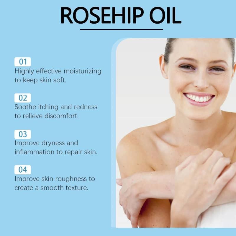Rosehip oil benefits infographic with smiling woman, moisturizing and soothing skin effects highlighted.