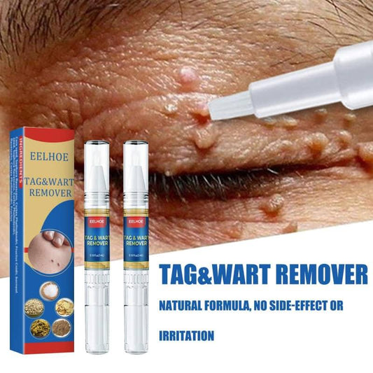 Tag and ward remover