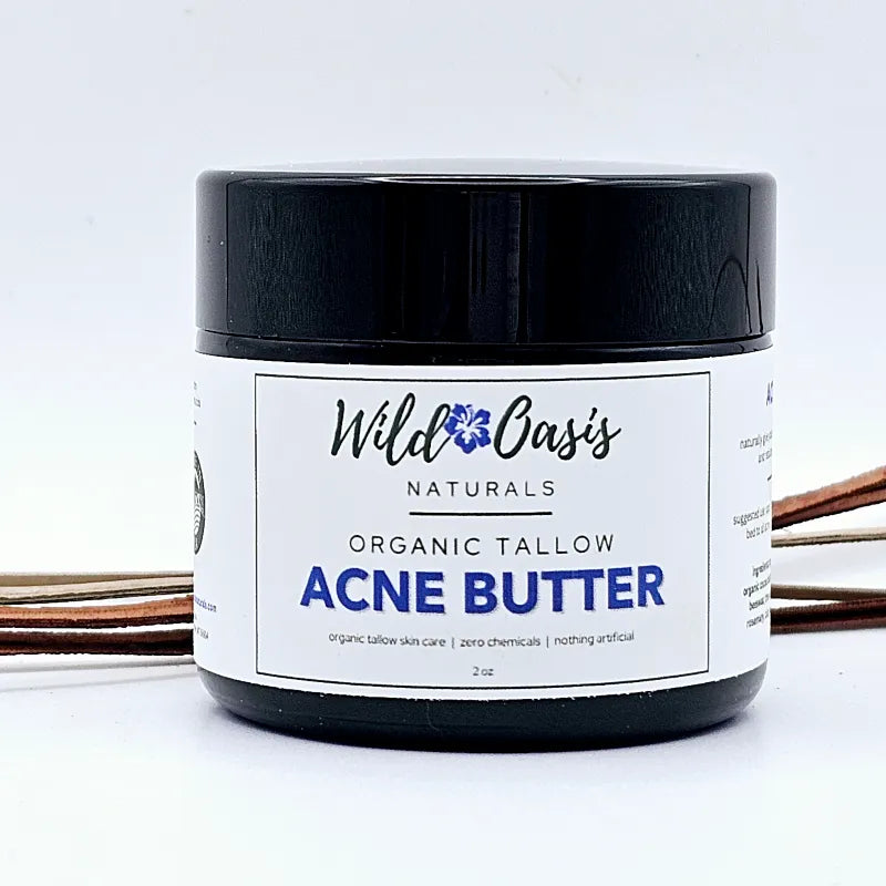 Jar of Wild Oats Naturals Organic Tallow Acne Butter on a white background