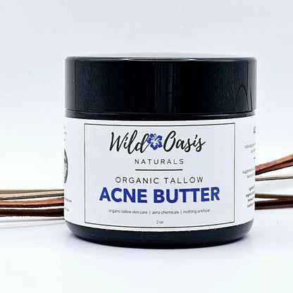Jar of Wild Oats Naturals Organic Tallow Acne Butter on a white background