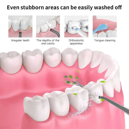 An informational graphic showing a close-up of a human mouth with teeth and pink gums, deep oral cavity cleaning, orthodontic cleaning, and tongue cleaning. 'Even stubborn areas can be easily washed off.