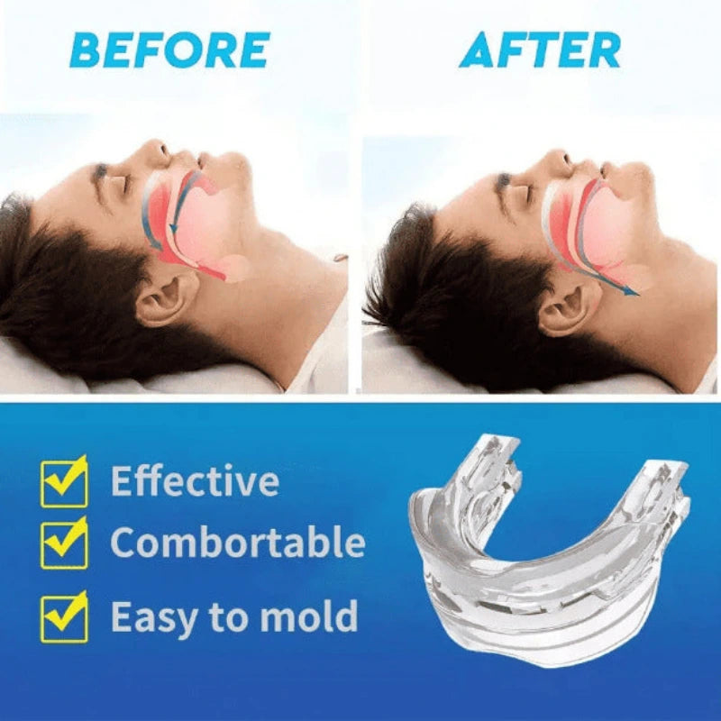 Before and after comparison of a person using a clear mouthguard with text indicating effectiveness, comfort, and ease of molding.