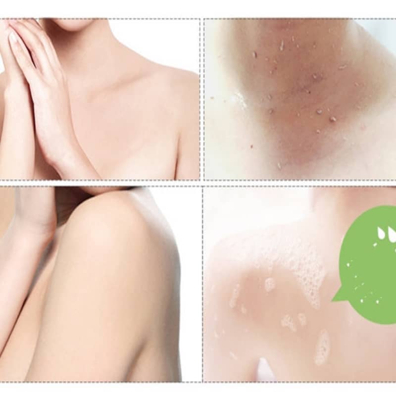 Collage of skin conditions with a green speech bubble on a white background