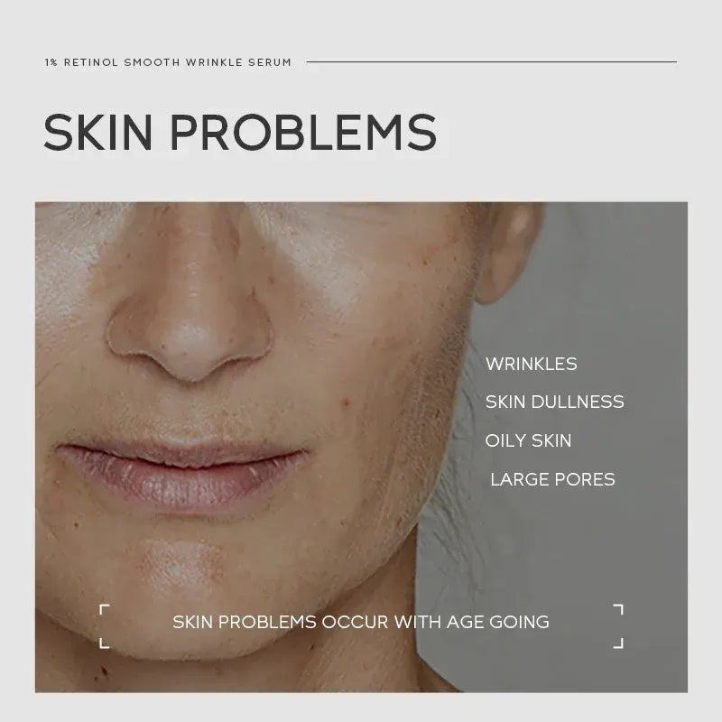 Close-up of a person's face with text about skin problems and a serum product.
