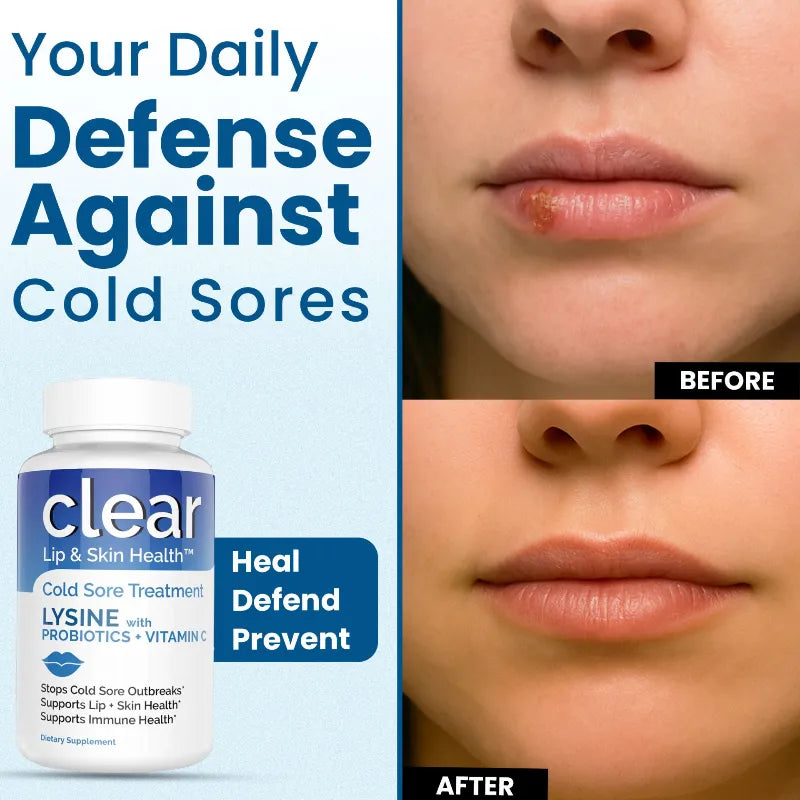 Clear lip and skin health product with 'Before' and 'After' images of lips.