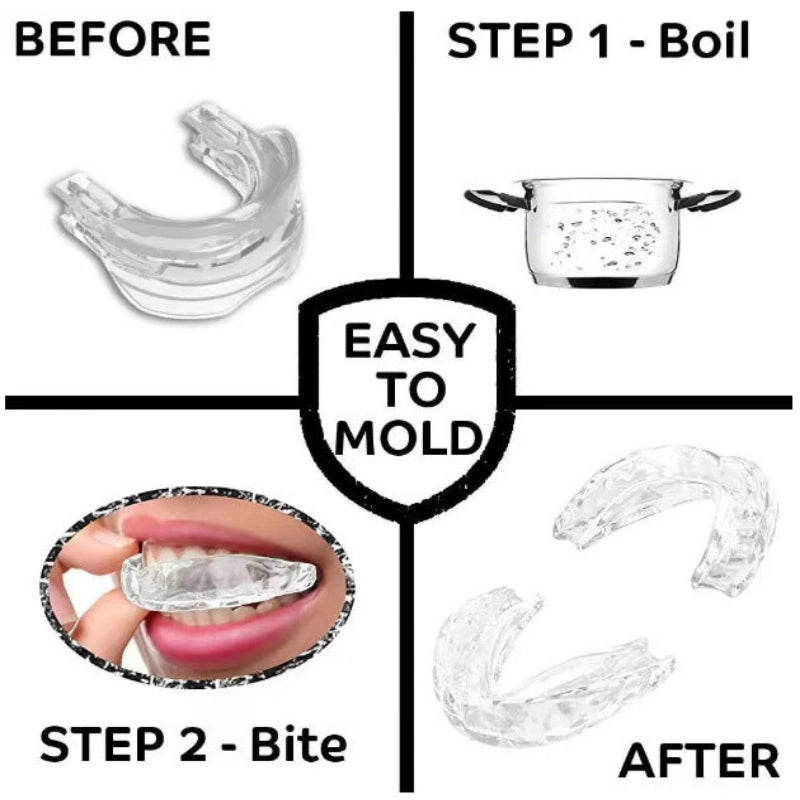 A four-panel instructional graphic showing how to mold a clear dental mouthguard. The center shield reads 'EASY TO MOLD.