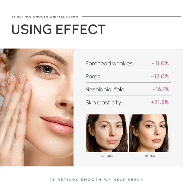 Promotional graphic for a 1% Retinol Smooth Wrinkle Serum. 