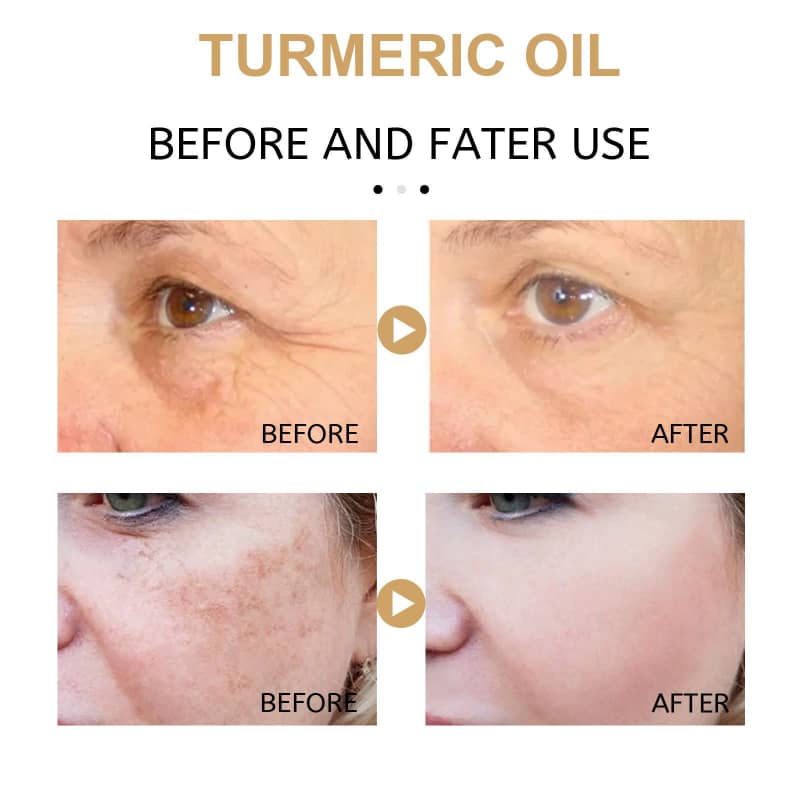 Turmeric Skin Moisturizing Lotion – Lifting, Firming & Spot Fading