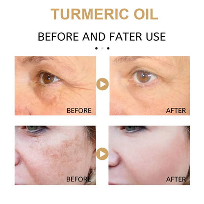 Turmeric Skin Moisturizing Lotion – Lifting, Firming & Spot Fading