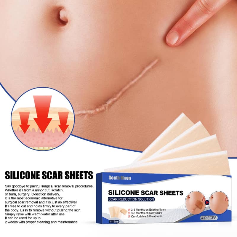 Silicone Scar Patches (4-Pack)