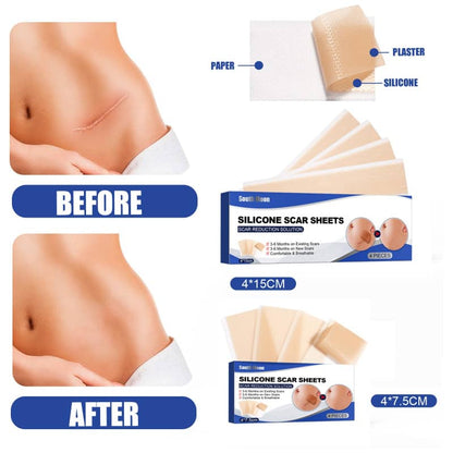 Silicone Scar Patches (4-Pack)