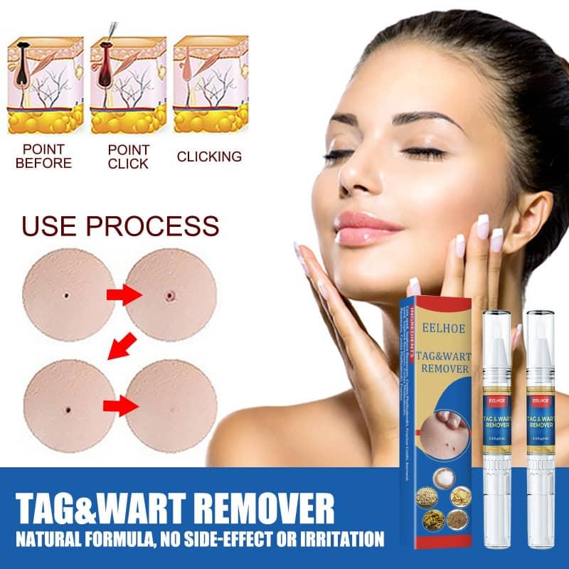 Before and after use