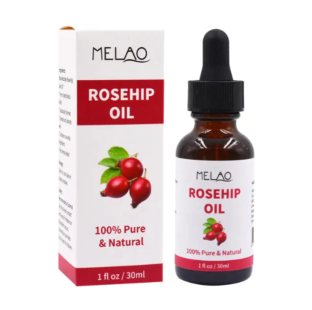 Rosehip Moisturizing Oil/ Supplements - 30ml