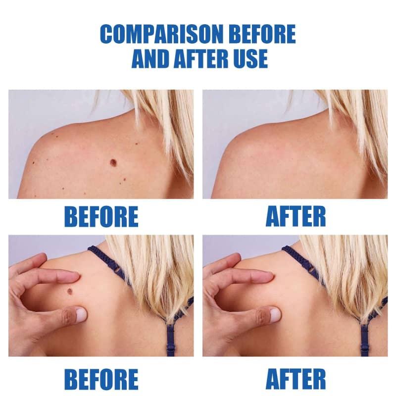 Comparison before and after