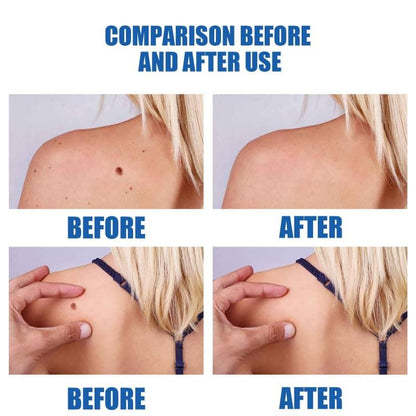 Comparison before and after