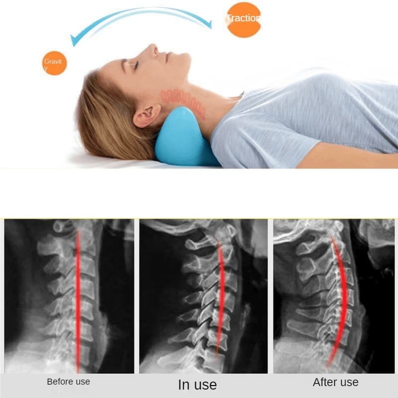 Woman using a neck pillow with X-ray images showing before, during, and after use.