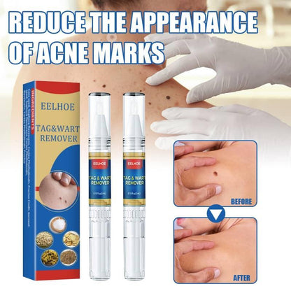 Reduce the appearance of acne marks