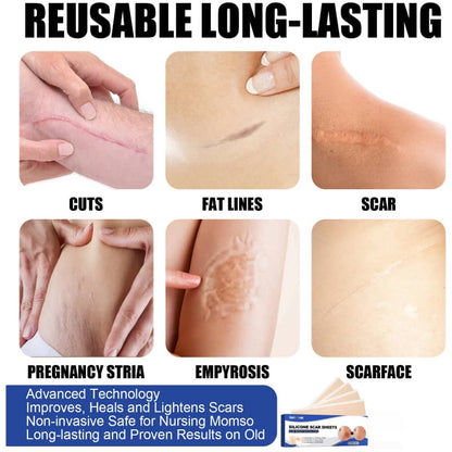 Silicone Scar Patches (4-Pack)