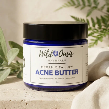 A jar of Wild Oasis Naturals Organic Tallow Acne Butter, featuring a dark blue glass jar, black lid, and white label, styled on a stone surface with soft green leaves and a beige cloth.